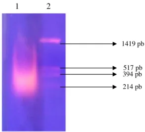 Gambar IV.3. Hasil isolasi RNA total menggunakan penanda pUC19/Hinf1. Jalur  1: Isolasi RNA total, Jalur 2: penanda pUC19/Hinf1 