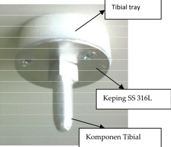 Gambar 5. Susunan alat pembuatan HAp.Gambar 3. Tibial Tray dan komponen tibial. Sebelum 