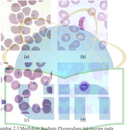 Gambar 2.3 Morfologi Stadium Plasmodium falciparum pada  apusan darah tipis (a) Bentuk cincin (b) Gametosit (c) 