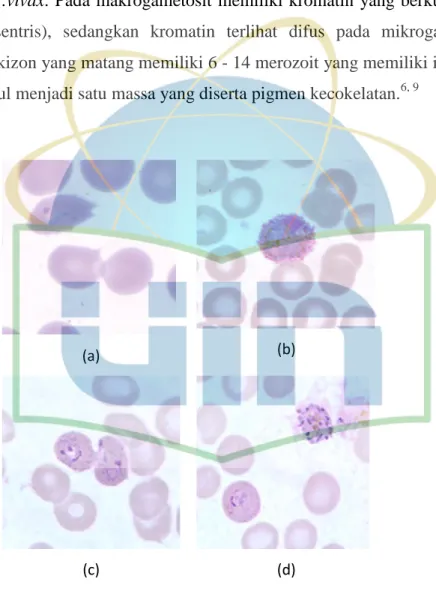 Gambar 2.5 Morfologi Stadium Plasmodium ovale pada  apusan darah tipis (a) Bentuk cincin (b) Gametosit (c) 