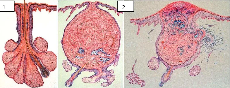 Gambar  2.1. Gambaran folikel sebasea 