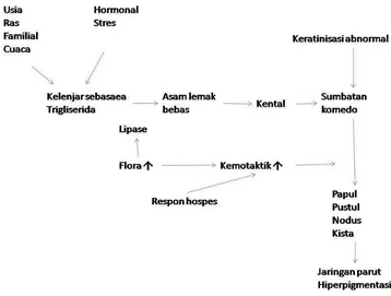 Gambar 2.2. Etiopatogenesis Akne 
