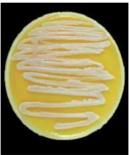 Gambar 1. Candida albicans (Mutiawati, 2016) 
