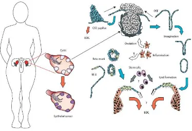 Gambar 2.Karsinogenitas epitel ovarium 