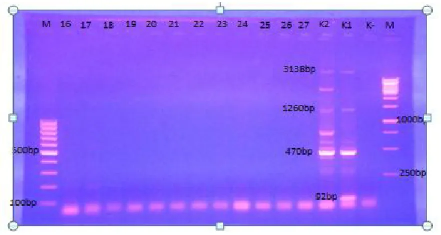 Gambar 11. Hasil elektroforesis produk  PCR 12 sampel isolat S.typhi 