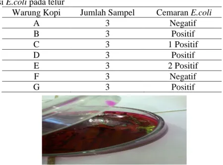 Tabel 1. Deteksi E.coli pada telur 