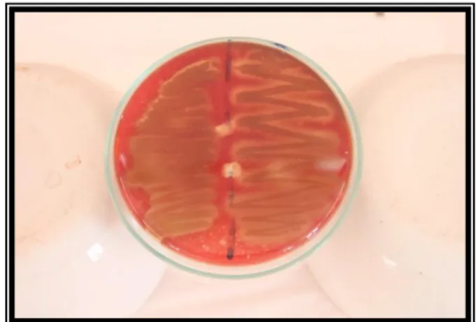 Gambar 4. Hasil kultur di Blood Agar (BA) 