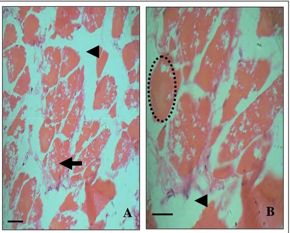 Gambar 7 Edema yang menyebabkan serabut otot tidak teratur (kepala panah). Nekrosa  serabut otot (Panah A)