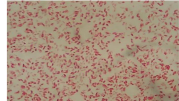 Gambar 20  Pewarnaan Gram Escherichia coli pada Saluran Pencernaan  Ikan Patin  