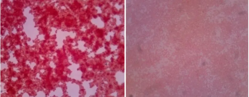 Gambar 2.  Identifikasi bakteri Gram positif (kiri) dan Gram negatif (kanan) 