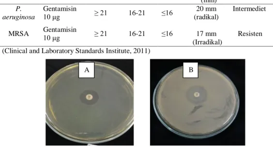 Tabel 2. Hasil uji sensitivitas bakteri terhadap gentamisin 