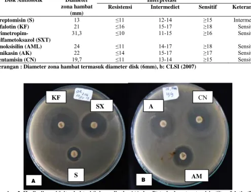 Tabel 2. Hasil uji sensitivitas bakteri terhadap antibiotik  Disk Antibiotik  Diameter 