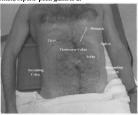 Tabel 1. Topografi abdomen 