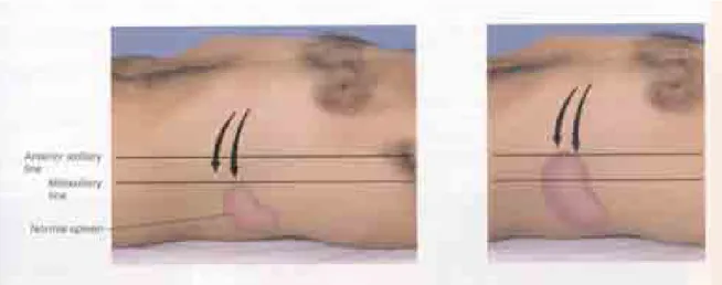 Gambar   10  D   Palpasi limpa   