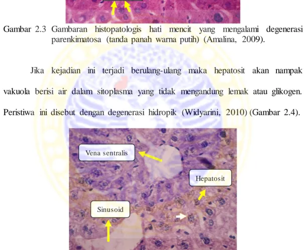 Gambar  2.4  Gambaran  histopatologis  hati  mencit  yang  mengalami  degenerasi  hidropik  (tanda  panah  warna  putih)  (Amalina,  2009)