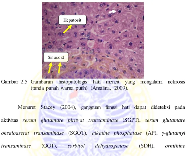 Gambar  2.5  Gambaran  histopatologis  hati  mencit  yang  mengalami  nekrosis  (tanda  panah  warna  putih)  (Amalina,  2009)
