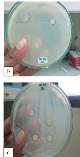 Gambar 4. Indikasi Penghambatan bakteri A.  hydrophila  (a)  M. varians           (b) M