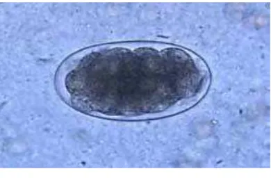 Gambar 2.5. Telur Hookworm 