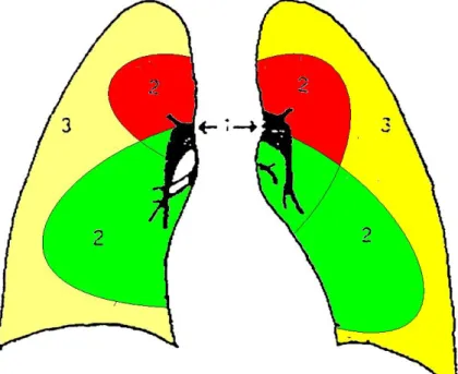 Gambar 5. Klasifikasi/pembagian paru meliputi 1) hilus, 2) perihiler, 3) perifer 