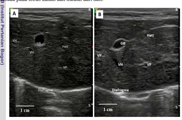 Gambar 4 Sonogram organ hati dengan arah transduser transversal. (A) Sonogram bagian kanan hati; (B) Sonogram bagian medial hati; VP, vena porta; VH, vena hepatika; GB, gallbladder (kantung empedu)