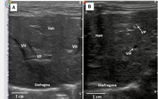 Gambar 8 Sonogram pembuluh darah pada hati kucing. (A) Arah potongan sagital; (B) Arah potongan transversal; VP, vena porta; VH, vena hepatika
