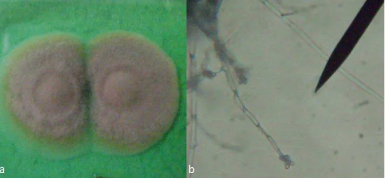 Gambar 1. Foto jamur taksa Dematophora sp1. : (a) koloni, (b) hifa