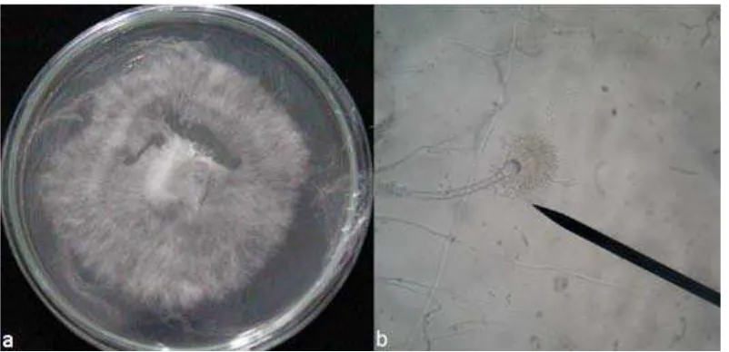 Gambar 4. Foto jamur taksa Aspergillus sp2. : (a) hifa   (b) koloni 