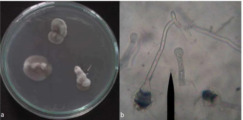 Gambar 5. Foto jamur taksa Aspergillus sp3. : (a) hifa   (b) koloni 