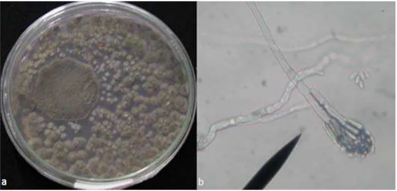 Gambar 7. Foto jamur taksa Penicillium sp1. : (a) hifa   (b) koloni 