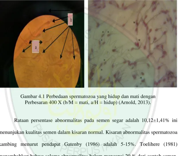 Gambar 4.1 Perbedaan spermatozoa yang hidup dan mati dengan   Perbesaran 400 X (b/M = mati, a/H = hidup) (Arnold, 2013)