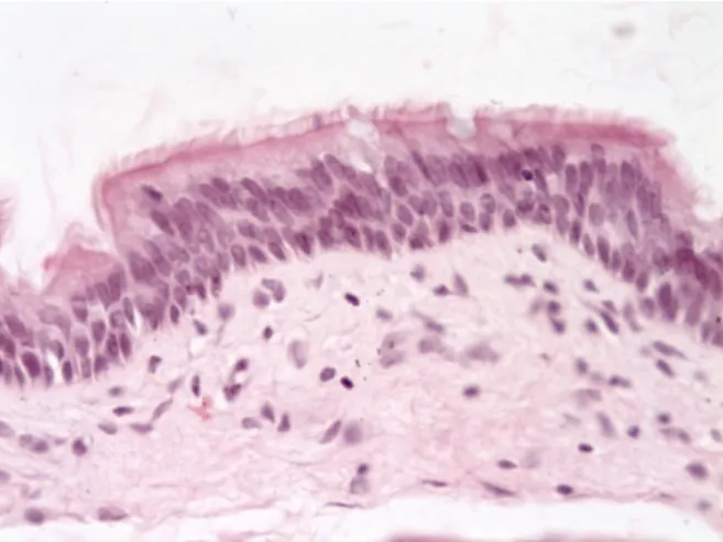 Gambar 2. Sel epitel transisional, pelapis nasofaring (Dikutip dari : Respiratory system pre lab       [cited 2010  Jan 5]
