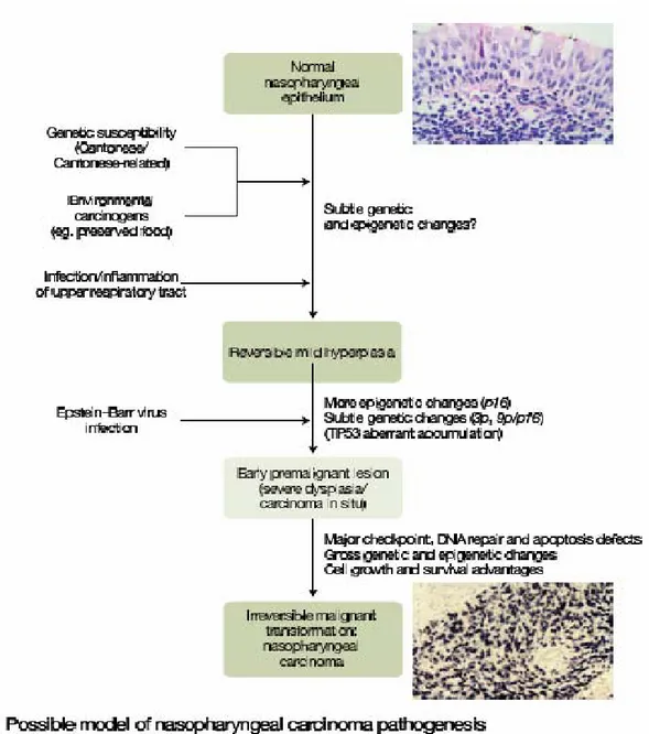 Gambar 3. Patogenesis karsinoma nasofaring (Dikutip dari: Tao Q, Anthony TC Chan.  Nasopahryngeal Carcinoma: Molecular Pathogenesis and Therapeutic Developments in Expert 