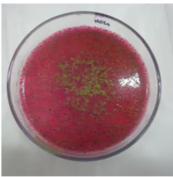 Gambar 1.  Bakteri E. coli yang diisolasi dari pasien ISK pada media EMB Agar plate  berwarna hijau metalik