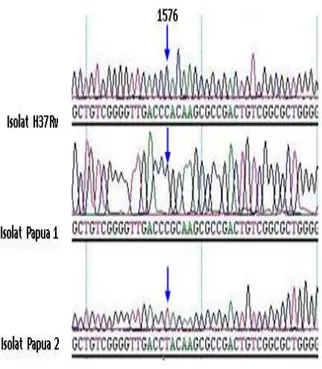 Gambar 2.   Elektroferogram  rpoB  beberapa  isolat  MDR-TB.  Pada  grafik  terlihat  adanya perubahan nukleotida isolat P1 dan P2  dibandingkan  dengan  isolat  standar  M
