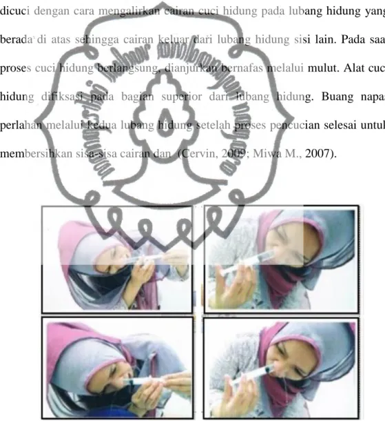 Gambar 2.3.Tehnik pencucian hidung