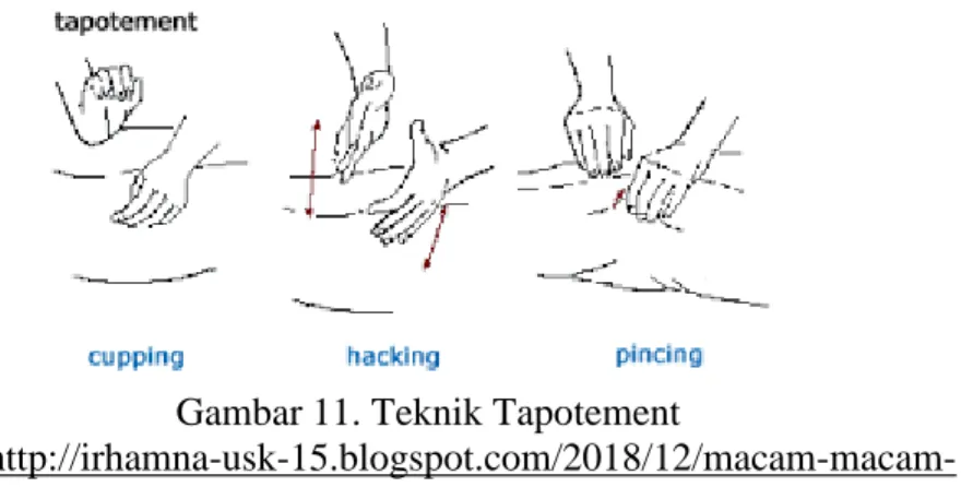 Gambar 11. Teknik Tapotement