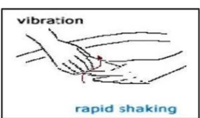 Gambar 12. Teknik Vibration  (Sumber:  ojs.unm.ac.id) 