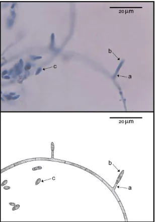 Gambar  4.  Pembentukan mikrokonidium Fusarium  oxysporum f. sp. cepae 