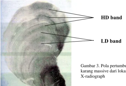 Gambar 3. Pola pertumbuhan (Density banding pattern)  karang massive dari lokasi studi Poriates lutea, revealed by  X-radiograph 