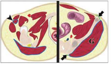 Gambar 5.   Ilustrasi pelvis pada bagian tulang iliaka (kanan) dan ramus pubis  interior (kiri)