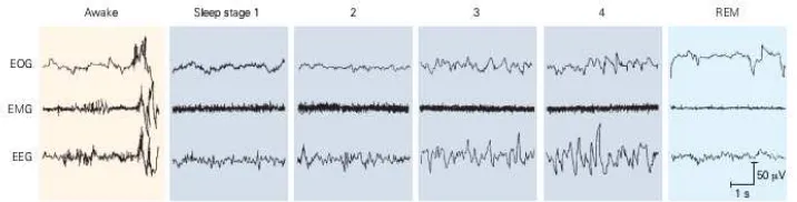 Gambar 2.1 Gambaran Gelombang Electrooculogram (EOG), Electromyogram(EMG), dan Electroencephalogram (EEG) pada Tiap-Tiap Stadium Tidur Sumber: K.E