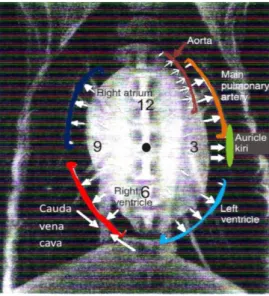 Gambar 25    Radiografi thoraks pada posisi DV/VD dengan pembesaran pada ruang jantung dan  beberapa pembuluh utama