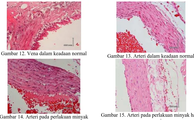 Gambar 15. Arteri pada perlakuan minyak hasil  regenerasi 