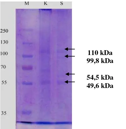 Gambar 1. Profil pita protein ginjal tikus ((Rattus norvegicus)Rattus Norvegicus) normal dengan tikus   pasca induksi Cyclosporine-A 