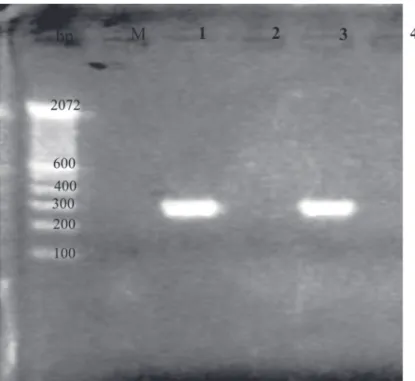 Gambar 1. Hasil Elektroforesis produk RT-PCR pada Gel Agarose.