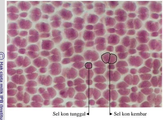 Gambar 14 Fotomikrograf sel kon tunggal dan sel kon kembar ikan kerapu sunu 