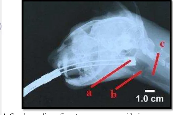 Gambar 4  Gambar radiografi saat  scope mencapai laring. a: scope, b: laring,  