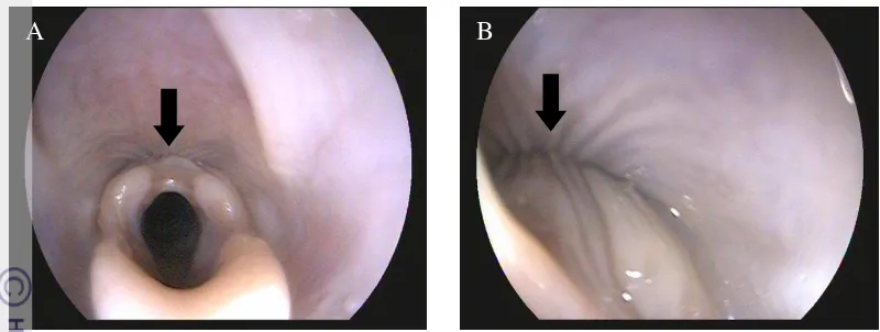 Gambar 5  Gambar endoskopi spinchter esofagus atas kucing lokal penelitian. (A) 