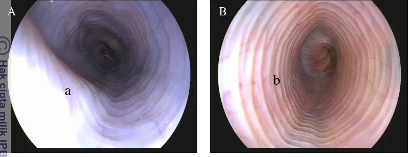 Gambar 8  Gambar endoskopi esofagus thoracalis normal kucing lokal penelitian. 