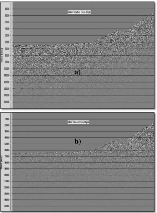 Gambar 8. Perbandingan Hasil (a) Sebelum dan (b) Sesudah Radon Filter. 